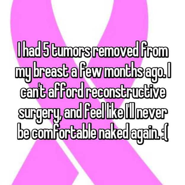 had-5-tumors-removed0from-breasts-reconstructive-surgery-stories