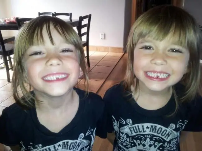 having-twins-lost-the-same-tooth
