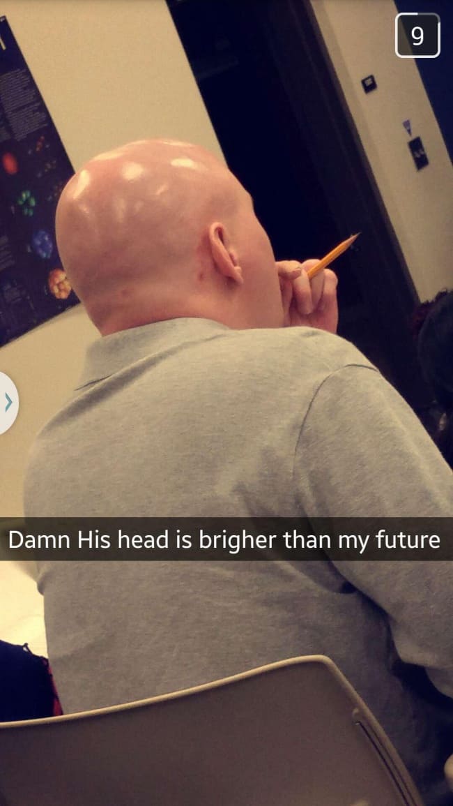 shiny_bald_head