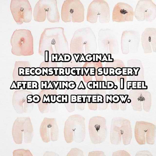 vaginal-reconstructive-surgery-stories
