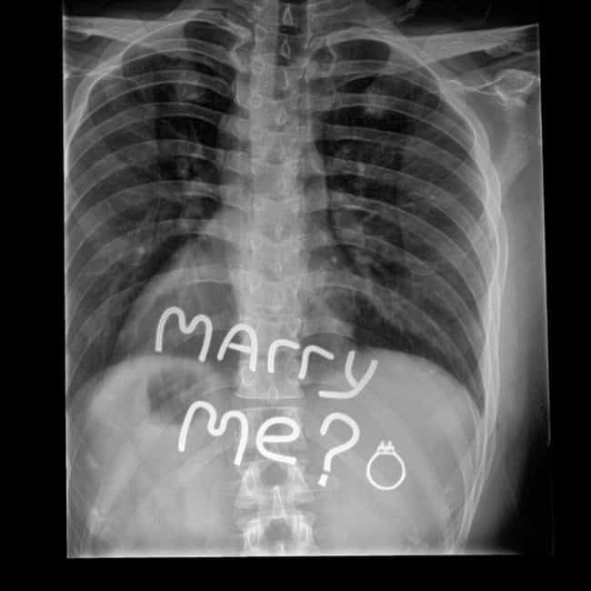 chest-x-ray-result-proposal