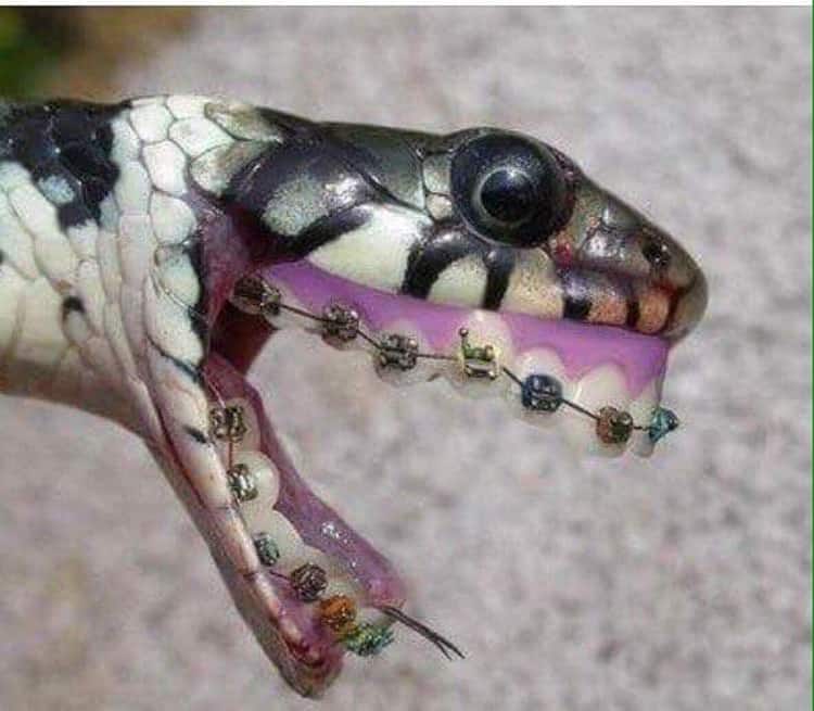 snake-teeth-braces-mind-bending-pics