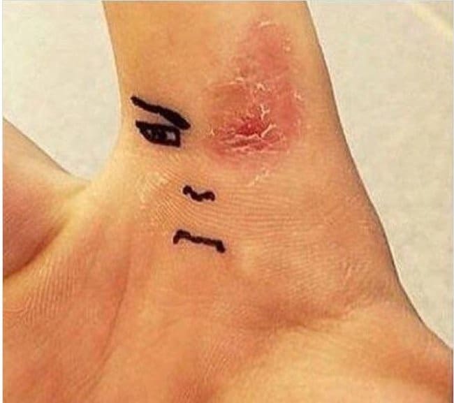 wounded-hand-makeover-humor-boosts-creativity