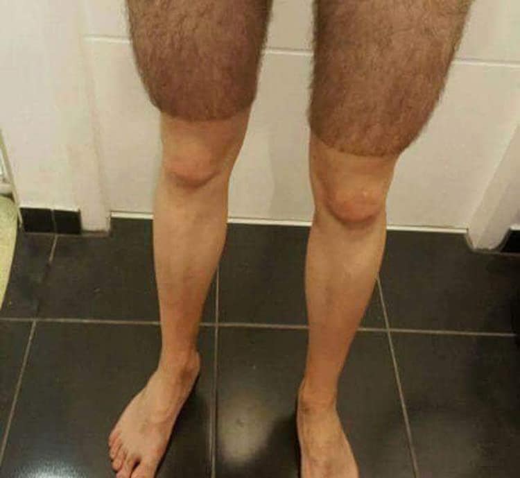 shaved-leg-hair-luckless-people