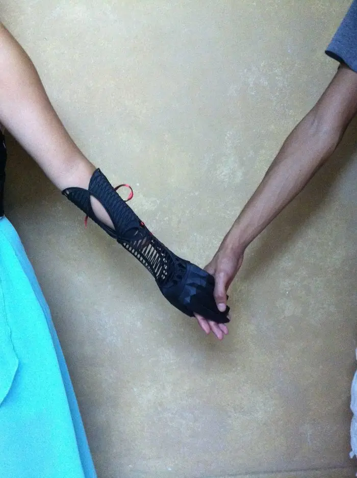 3d printing brilliant creations prosthetic arm