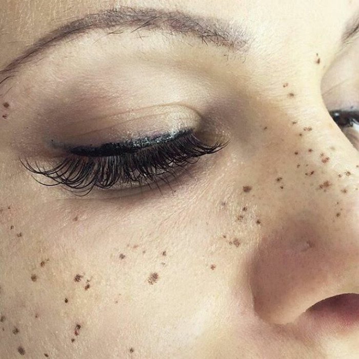 Closeup of a Dark Shade Freckle Tattoos on Face