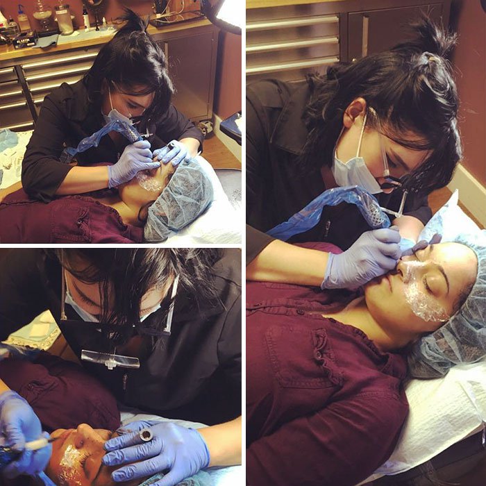 Lady Undergoing a Freckle Tattoo Procedure