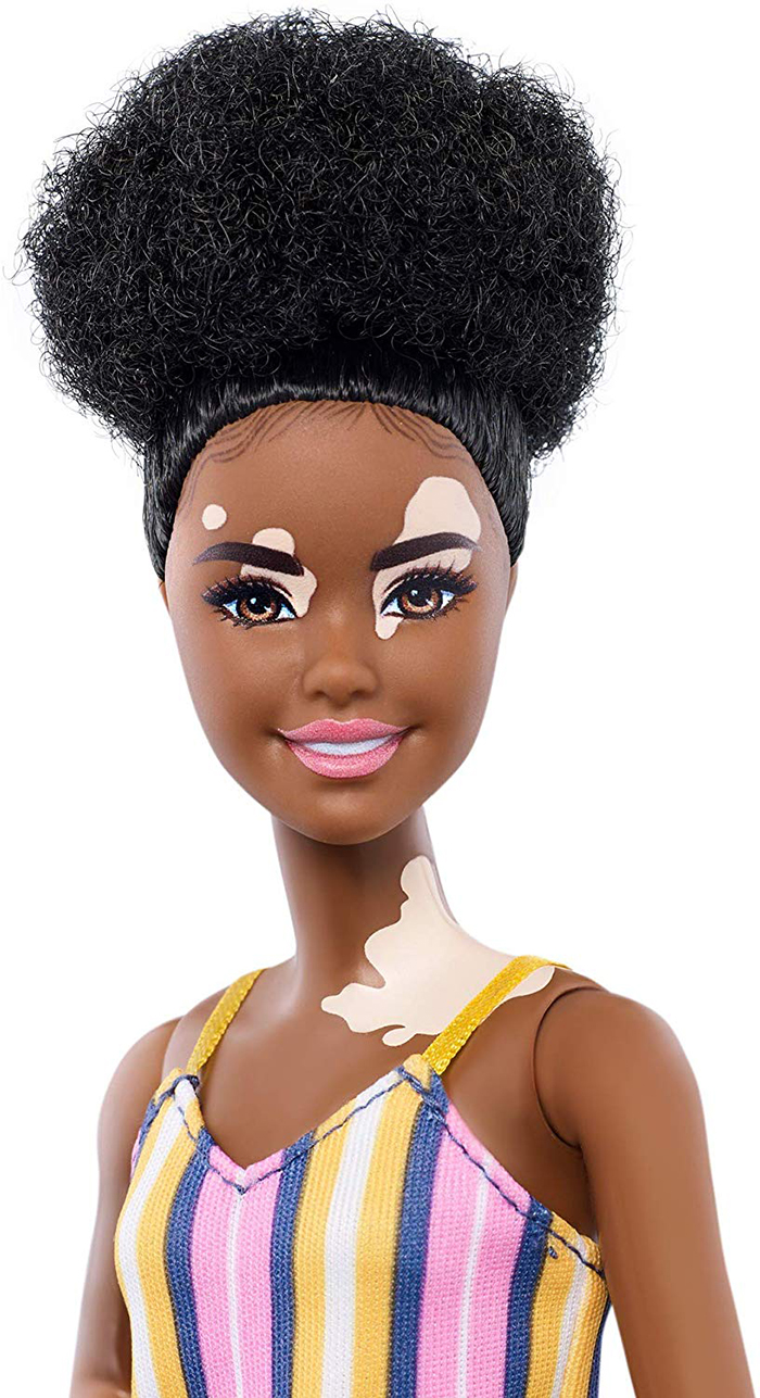 Vitiligo Barbie with curly hair