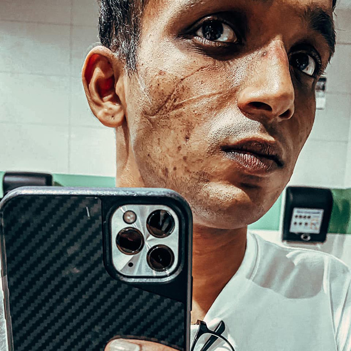 Benjamin Ong Overworked Doctor Selfie