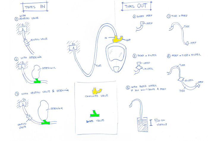 Isinnova Makeshift Ventilators for COVID-19 Patients Blueprint