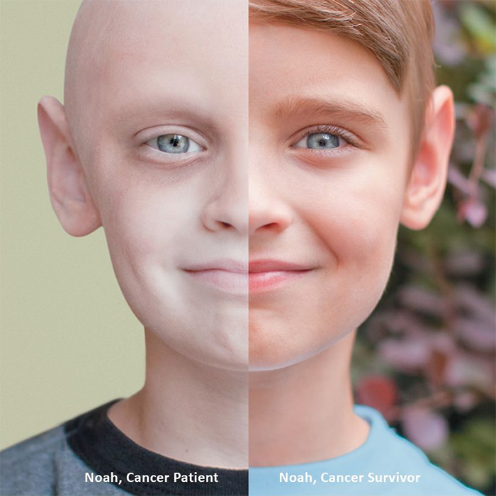 comparison images of a cancer survivor