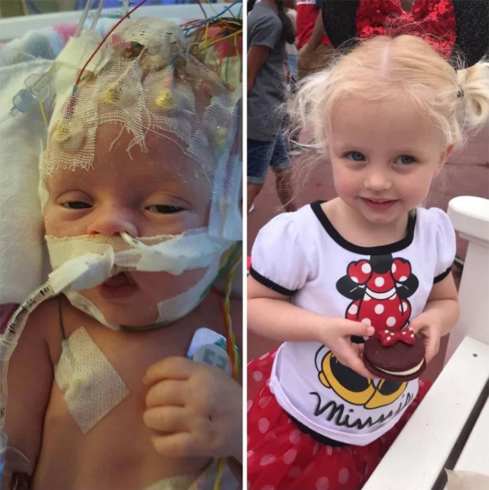 wholesome pics baby recovers from surgeries