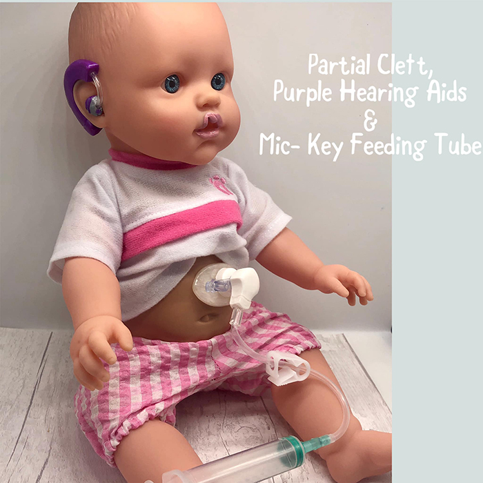 baby doll with partial cleft, hearing aids, and mic-key feeding tube
