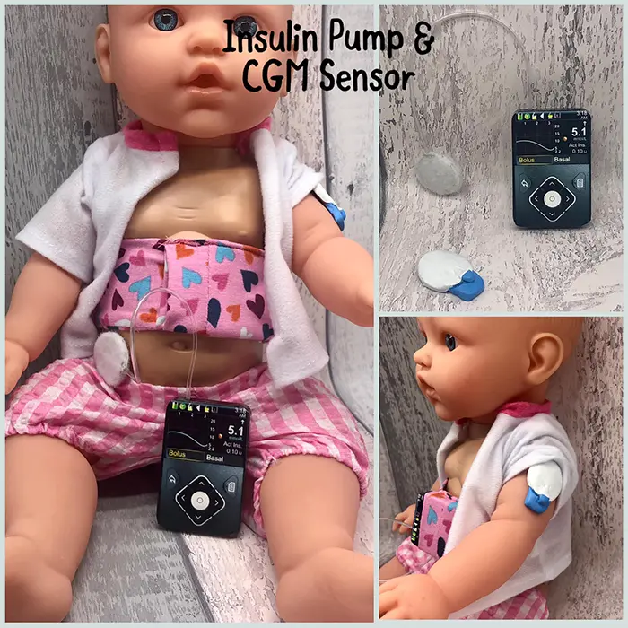 baby toy figure with cgm sensor and insulin pump