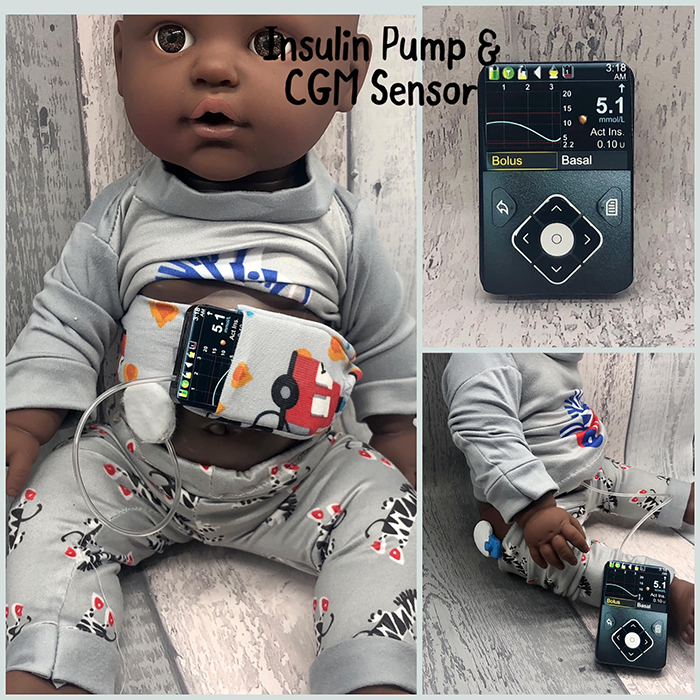 baby toy figure with insulin pump and cgm sensor