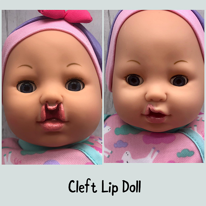 baby toy figures with cleft lip