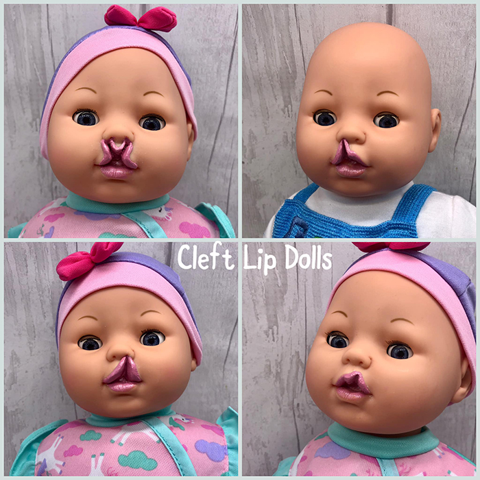 baby toy figures with cleft lips