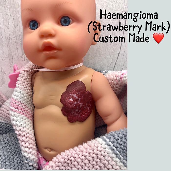 custom-made baby toy figure with haemangioma