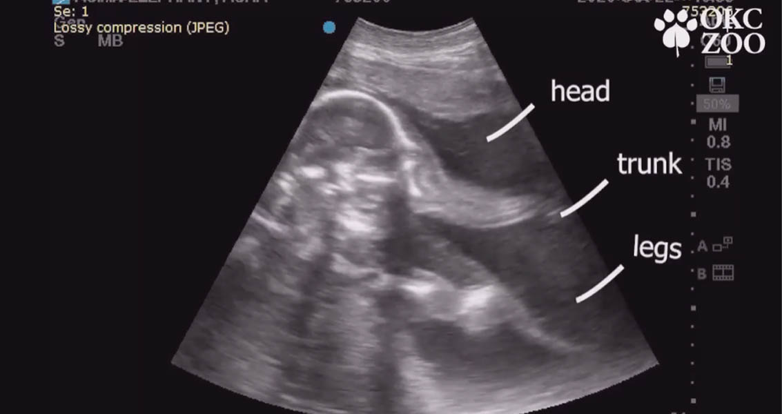 Baby elephant ultrasound