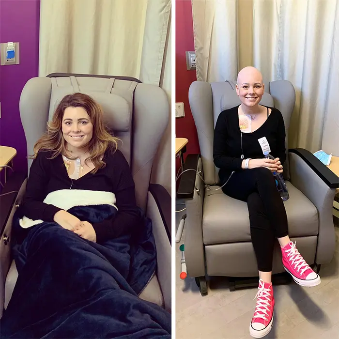 comparison images first day vs last day of chemo
