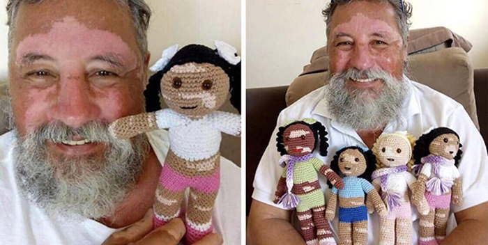 old people being wholesome grandfather with vitiligo crocheting dolls with the same condition