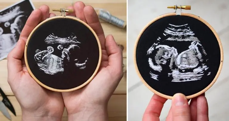 Ultrasound Embroideries