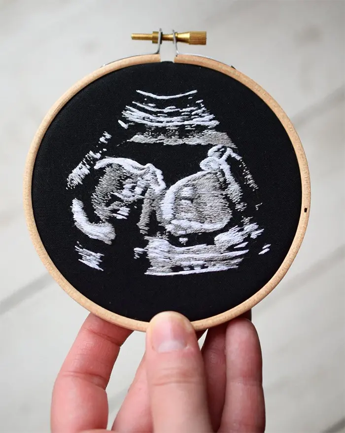 ultrasound embroideries 4-inch